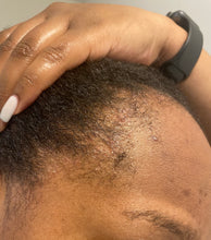 Load image into Gallery viewer, Moisturizing Regrowth Oil
